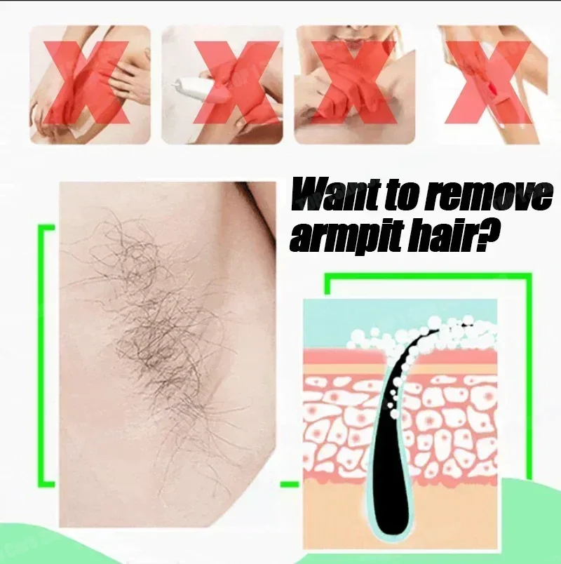 بخاخ إزالة الشعر القوي، مثبط ن - مراجعة Hair Care Korean Products وسعره